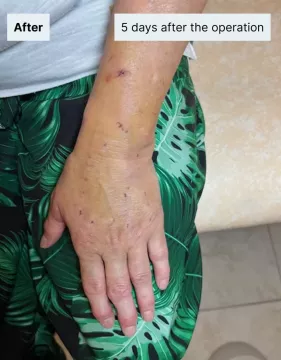 after-left-hand