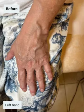 before-left-hand