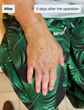 after-right-hand